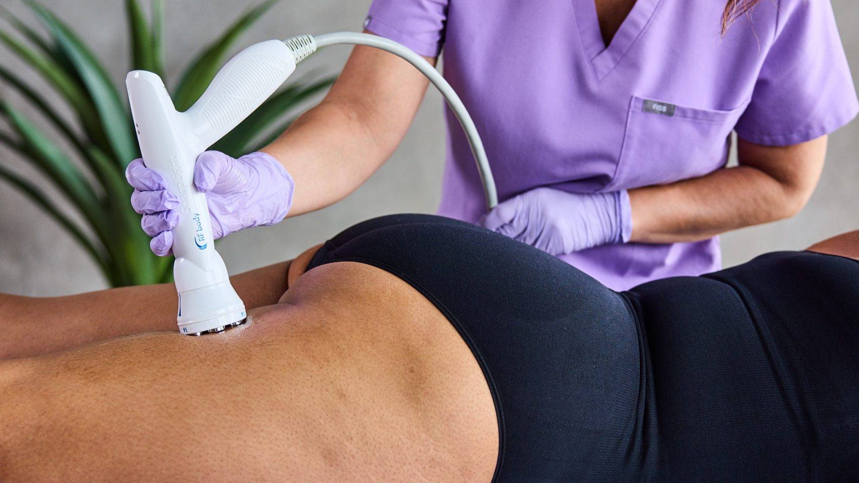 body contouring cellulite removal windsor