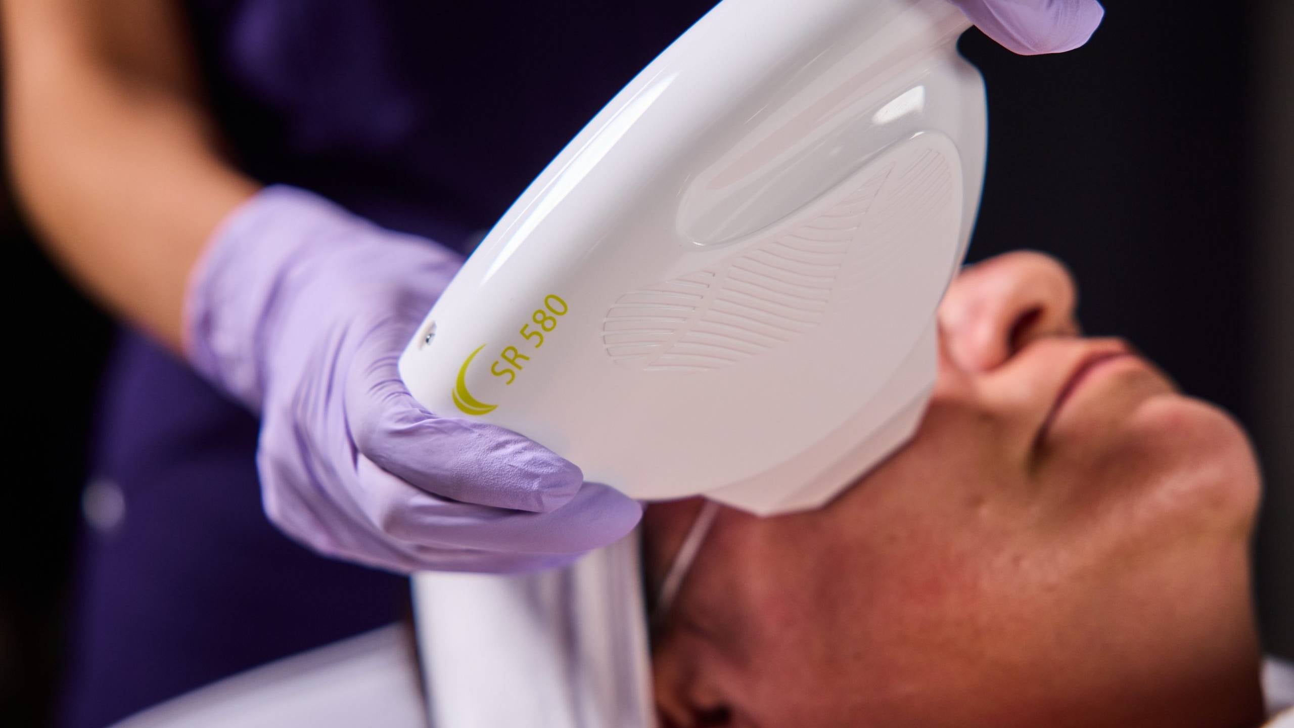 thermal face lift