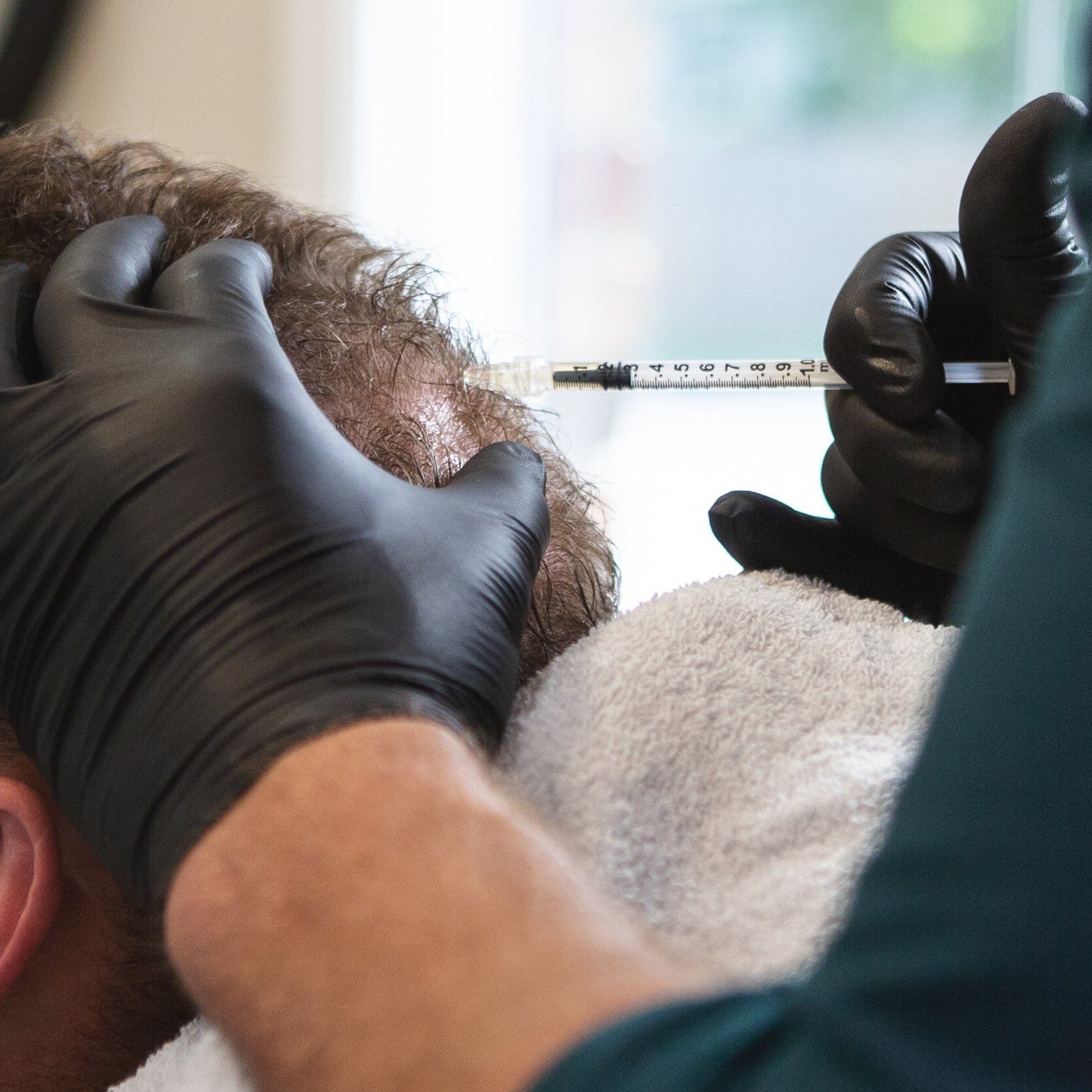 PRP_Hair PRP for hair restoration - Revery Medical Aesthetics