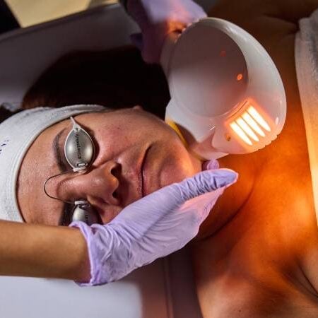 resurface-skin-treatment