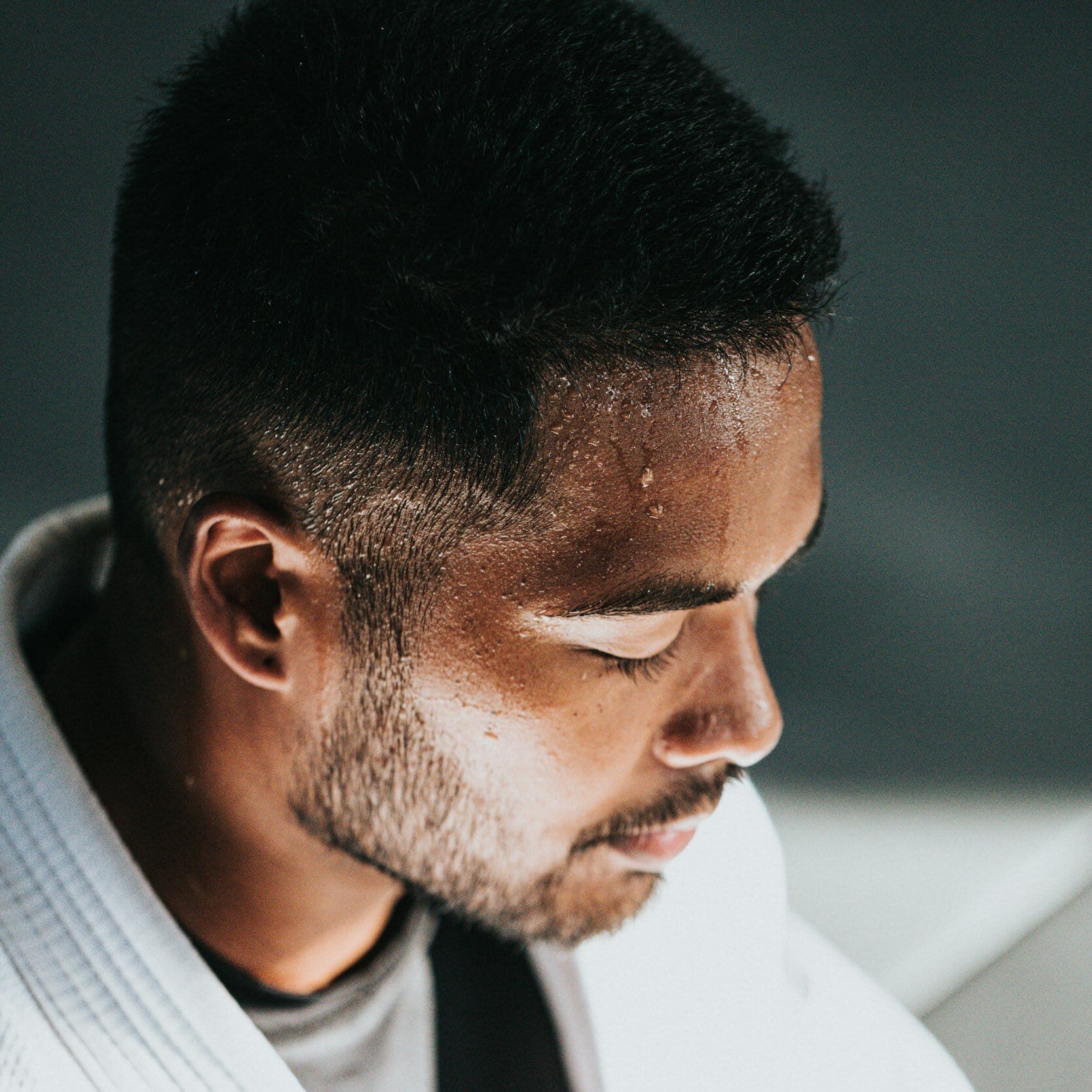 hyperhidrosis treatment windsor