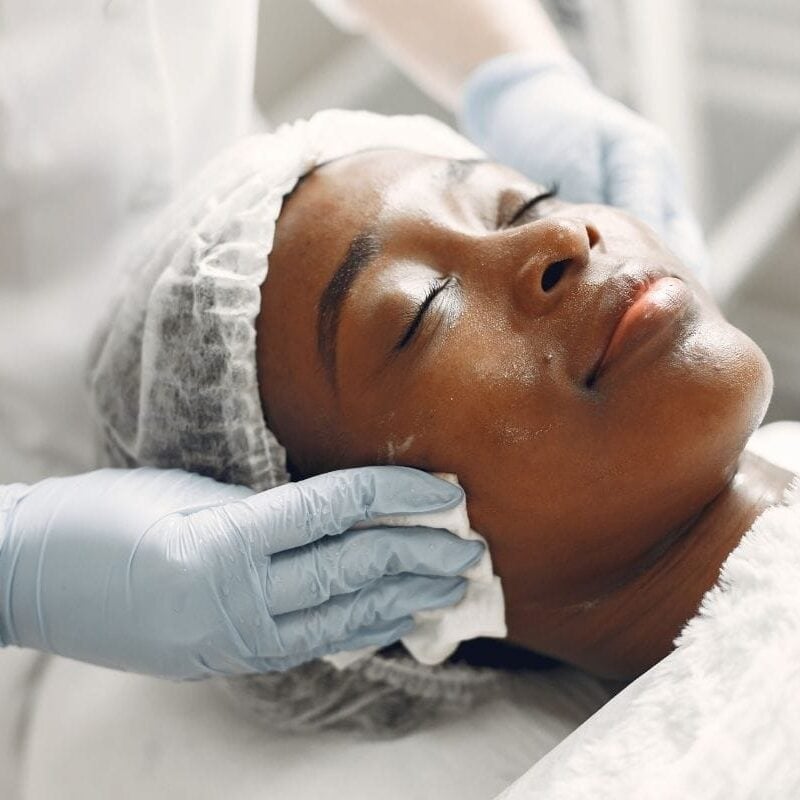 windsor-facial facial lasalle revery medical aesthetics